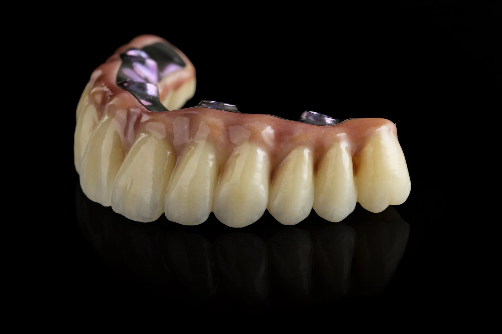 Dynamic Dent fogtechnikai munka
